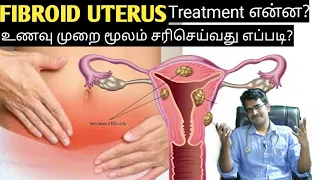 Fibroid uterus causes&diet explanation in tamil/medical awareness in tamil