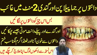 Best Teeth Whitening & Cleaning Tips at Home in Urdu | Dant Saaf Karne Ka Tarika Dr Sharafat Ali New