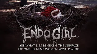 ENDO GIRL - a short documentary on Endometriosis