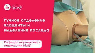 Ручное отделение плаценты и выделение последа