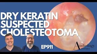 DRY KERATIN REMOVAL/SUSPECTED CHOLESTEOTOMA - EP911