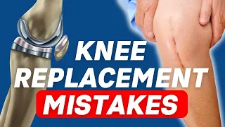 Top 5 Mistakes After Knee Replacement (MUST WATCH)