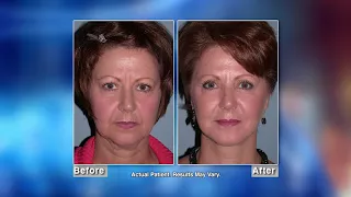 The Modern Facelift with Philadelphia, PA Facial Plastic Surgeon Timothy Greco, MD, FACS