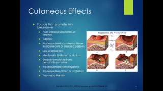 Chapter 25 Lecture Immobility and Associated Problems