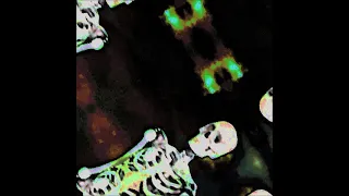 Bones - CtrlAltDelete (remix)