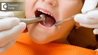 Is Root Canal Treatment recommended for children? - Dr. Jaswanth Reddy