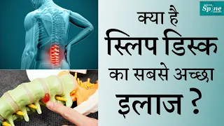 क्या है स्लिप डिस्क का सबसे अच्छा इलाज ? Best treatment for Slip Disc, Sciatica, Back Pain in Hindi