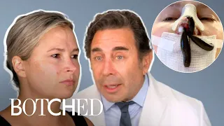 Holly’s Razor Thin Nose FULL TRANSFORMATION | Botched | E!