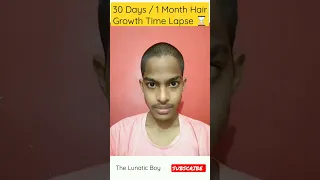 1 Month Hair Growth Time Lapse | 30 Days Hair Growth Time Lapse Challenge | Bald to Hair Growth