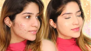 HIDE Acne / Pimples / Scars With MAKEUP