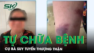 Tự Chữa Đau Xương Khớp, Cụ Bà Suy Tuyến Thượng Thận | SKĐS