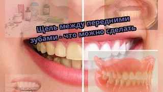 Щель между передними зубами - что можно сделать