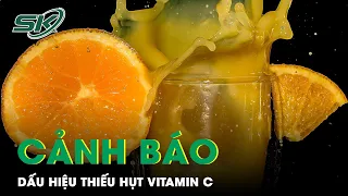 Cảnh Báo: Dấu Hiệu Thiếu Hụt Vitamin C | SKĐS