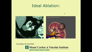 SIR-RFS Webinar (9/17/2018): Percutaneous Renal Ablations