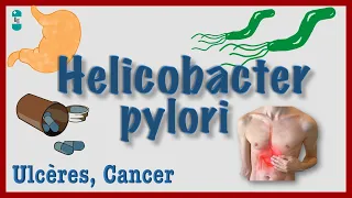 Helicobacter pylori : Physiopathologie, Ulcères, Diagnostic, Traitement