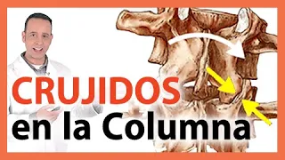 🛑CHASQUIDOS en la Columna - 🤔 Qué son? PORQUÉ SE PRODUCEN los crujidos? Yoga Terapéutico - CURIOSO!!