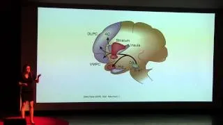 The brain is our last frontier and consciousness is expanding | Dr. Heather Berlin | TEDxYouth@KC