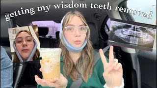 GETTING MY WISDOM TEETH REMOVED...(vlog and recovery process)