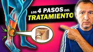 ⛔ ALERTA: 𝗣𝗲𝗿𝗶𝗼𝘀𝘁𝗶𝘁𝗶𝘀 𝘁𝗶𝗯𝗶𝗮𝗹 ! 💀 Qué es y CÓMO SE CURA el "dolor de espinilla" o de tibia