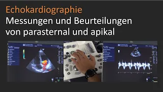 Echokardiographische Messungen und kardiale Beurteilungen von parasternal und apikal