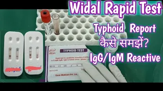 Widal Rapid Test | Typhoid Anitibodies detection Test | Widal Test Report