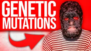 5 Unusual Genetic Mutations Of The Human Body