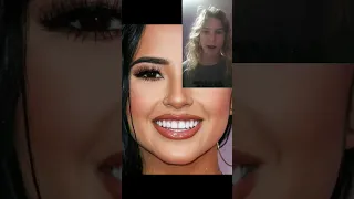 Becky g got her teeth fixed