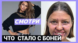 Что стало с Викторией Боней!