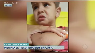 PICADO POR ARANHA: MENINO SE RECUPERA BEM EM CASA