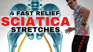 Sciatica Pain Relief Stretches | Dr. Jon Saunders