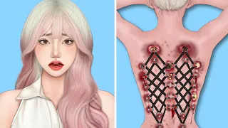 ASMR Corset Piercing Worm & Maggot Removal | Severely Injured Animation