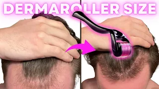 The Best Dermarolling Size for Quickest Hair Growth