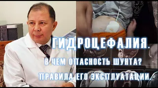 ГИДРОЦЕФАЛИЯ. В ЧЕМ ОПАСНОСТЬ ШУНТА? ПРАВИЛА ЕГО ЭКСПЛУАТАЦИИ.