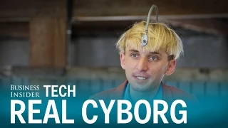 This real-life cyborg has an antenna implanted into his skull