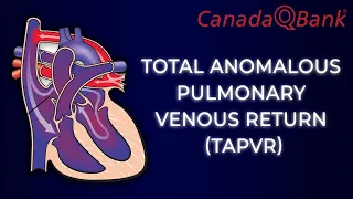 Total Anomalous Pulmonary Venous Return (TAPVR)