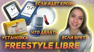 Freestyle Libre || Установка || Что делать если врет? Пошла кровь || Не работает? || Все ответы тут