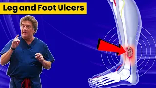 Leg and Foot Ulcers | Kaplan Surgery