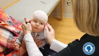 New technology for treating flat head syndrome in babies