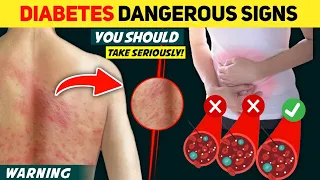 9 Diabetes Emergency Symptoms You Should Take Seriously!