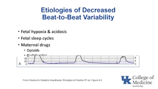 Antepartum Intrapartum Fetal Assessment - Dr. Fragneto
