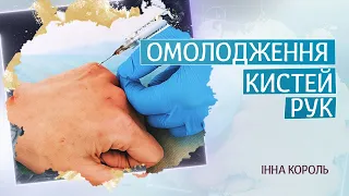 Процедура омолодження кистей рук