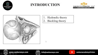 Management of Orbital Floor Fractures