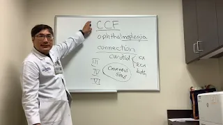 Ophthalmoplegia of Carotid Cavernous Fistula