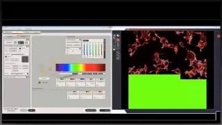 Basics of confocal laser scanning microscopy