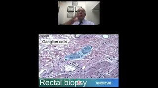 Dr  De la Torre PatientFamily (Hirschsprung/Colorectal)