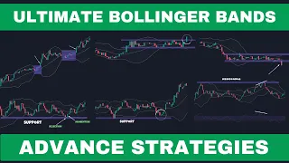 Advance Bollinger Bands Trading Strategies | Bollinger Bands Course