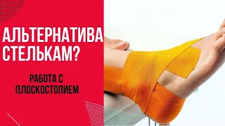 Тейпирование при плоскостопии || Работа с плоскостопием дома