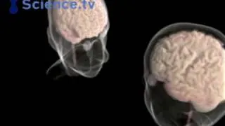 The difference between men and women's brains