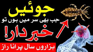 joway Sar Me Kiyo Hoti hin | Juwain khatam karne ka tarika joway khatam karne ka wazifa Mehrban Ali