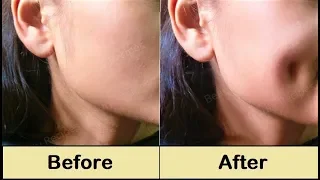 How To Get Dimples Fast & Naturally - Simple Facial Exercise to get Dimples without Surgery